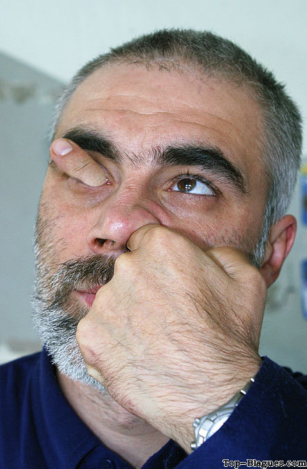 a�e mon oeil