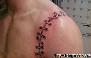 tatouage cicatrice