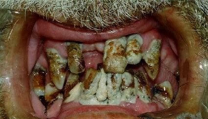 Mais où est son dentiste ?