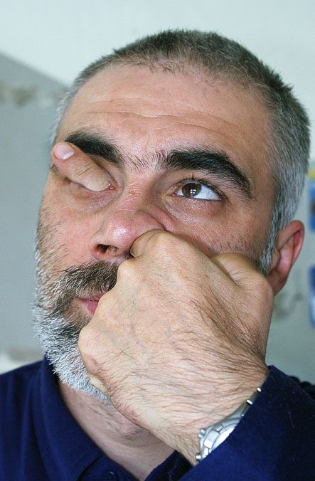 Aïe mon oeil