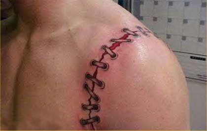 Tatouage cicatrice